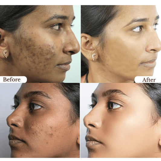 Orange Exfoliating Gel